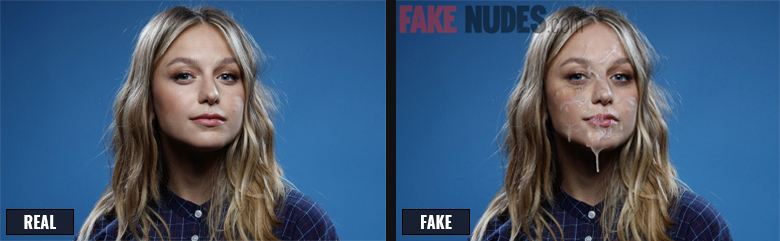 Melissa Benoist Fake Facial Before After