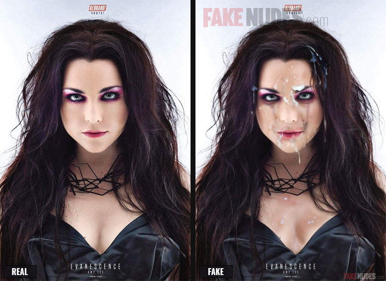 Amy Lee Facial Before After